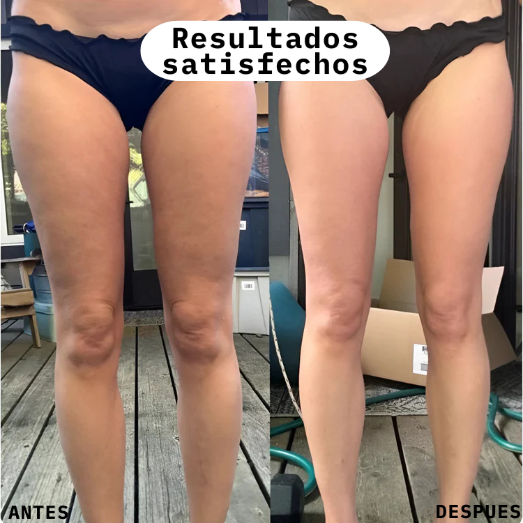 Masajeador anticelulitis, ¡¡facil , rapido y comodo¡¡