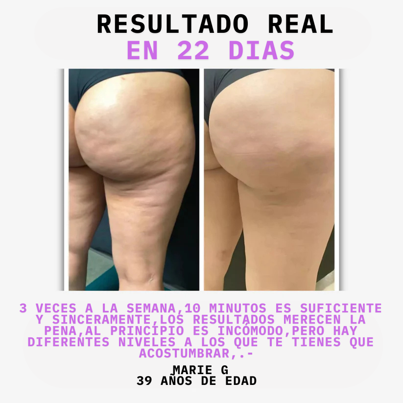 Masajeador anticelulitis, ¡¡facil , rapido y comodo¡¡